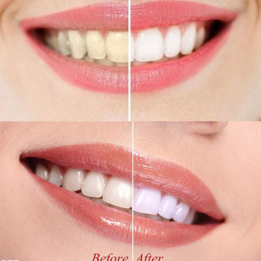 Bamboo Charcoal Teeth Tooth De - Teeth Whitening Remedies 리뷰 및 가격