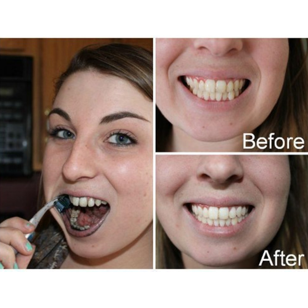 Bamboo Charcoal Teeth Tooth De - Teeth Whitening Remedies 리뷰 및 가격