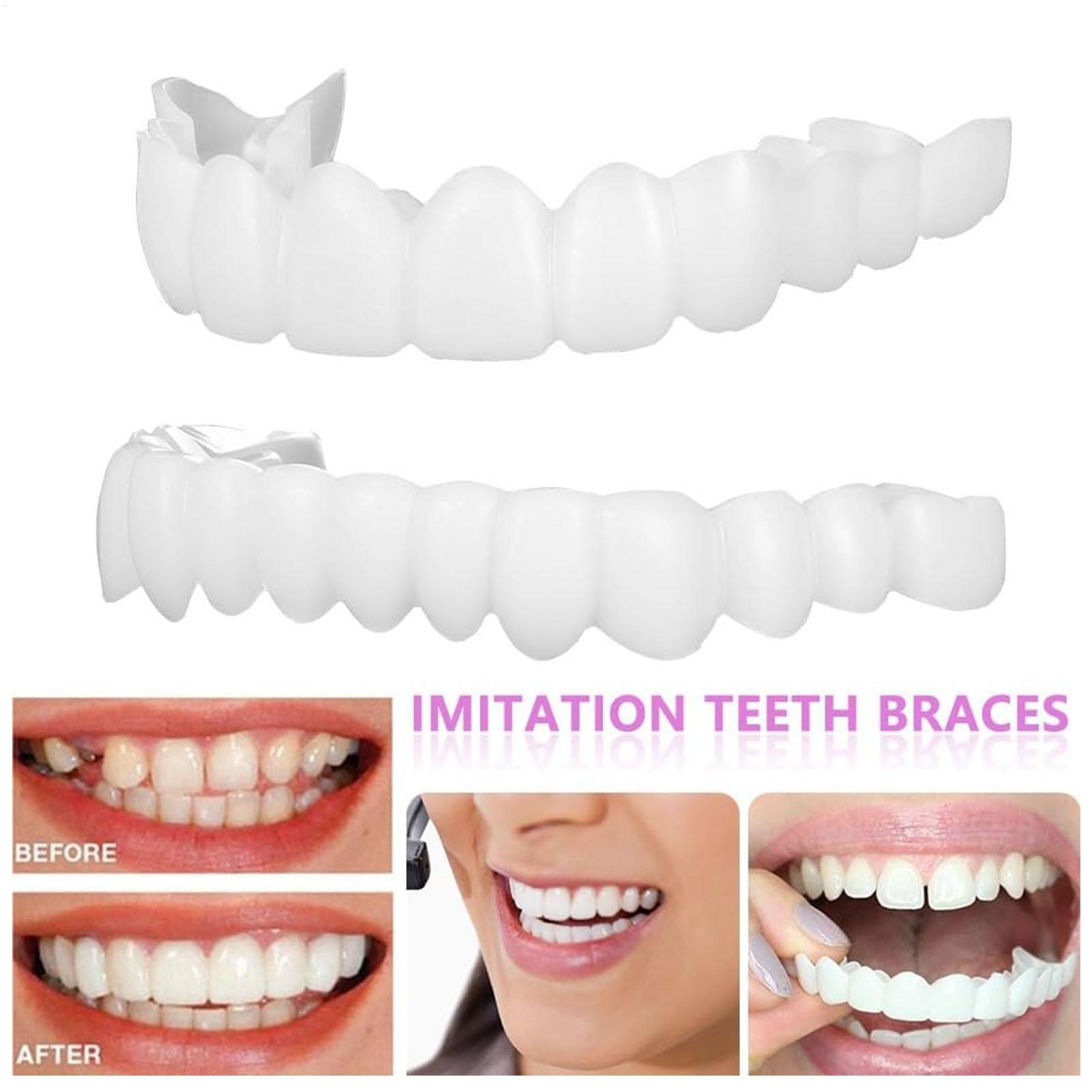Dental Upper Lower Fake Teeth  - Teeth Whitening In Office 리뷰 및 가격