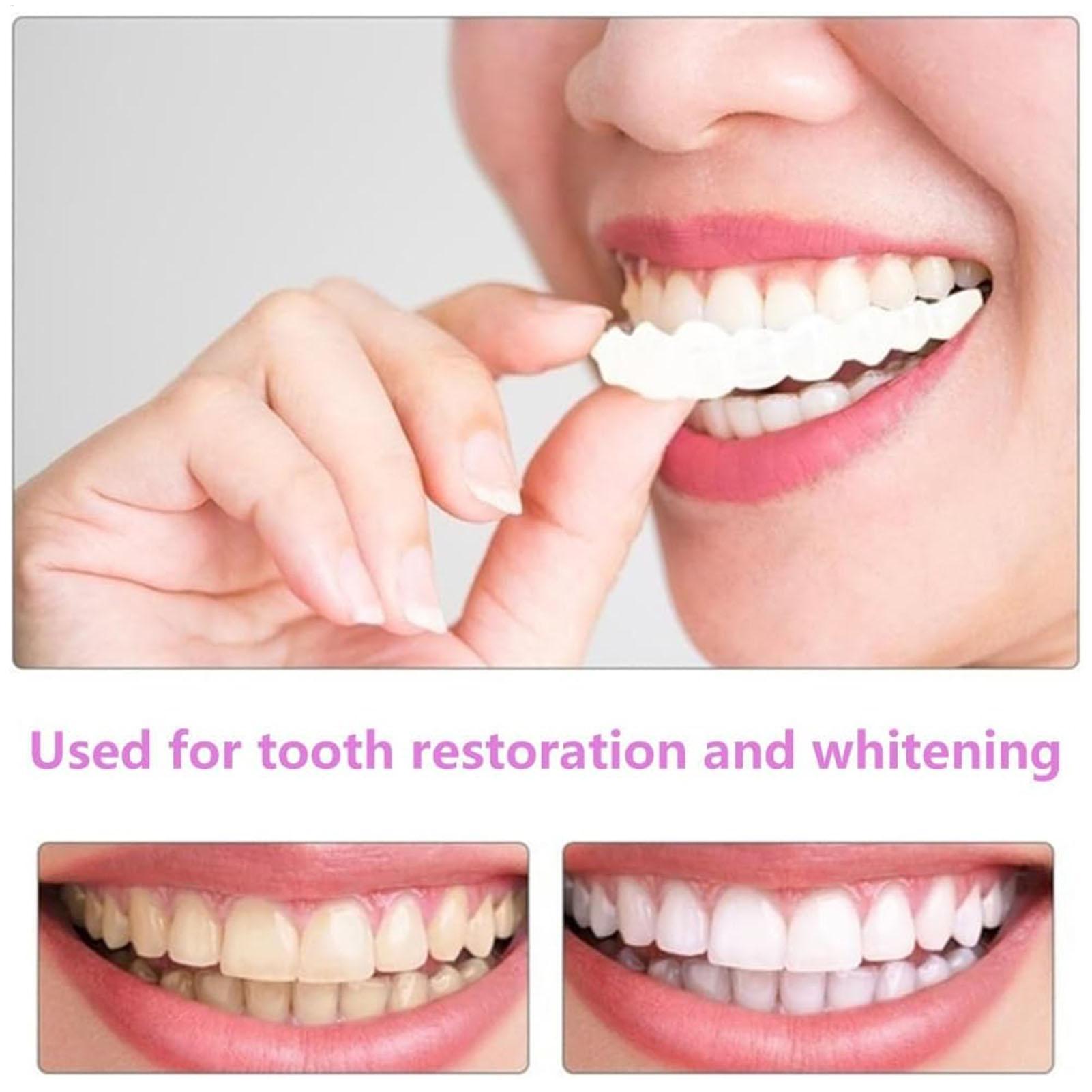 Dental Upper Lower Fake Teeth  - Teeth Whitening In Office 리뷰 및 가격