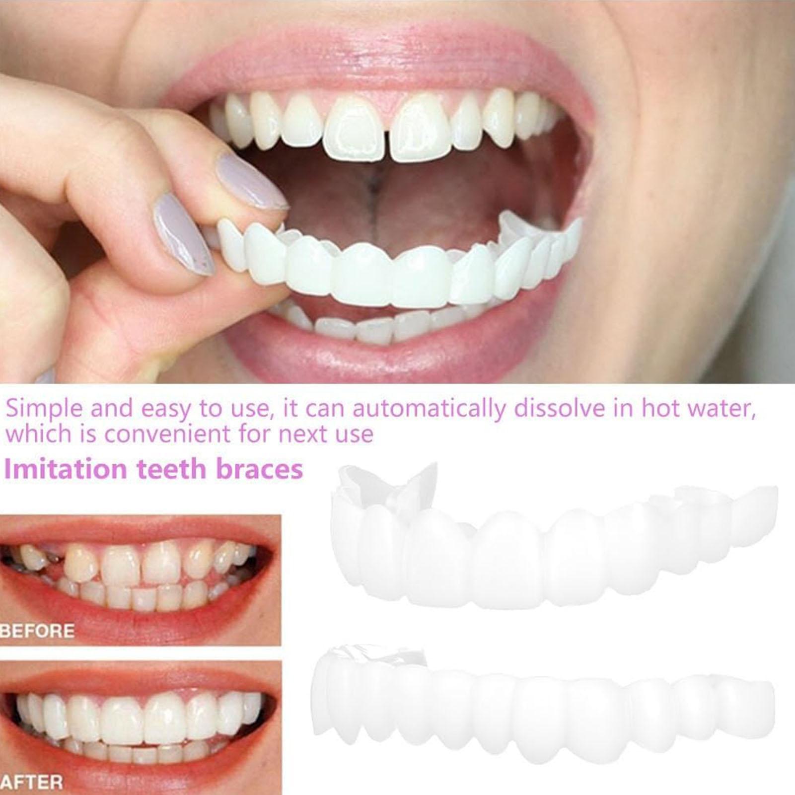Dental Upper Lower Fake Teeth  - Teeth Whitening In Office 리뷰 및 가격