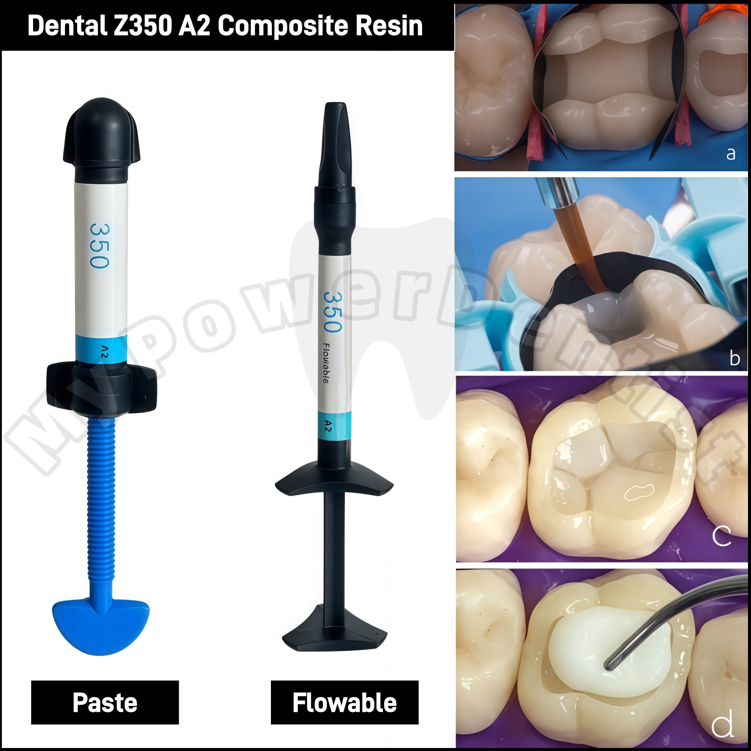 Z350 A2  Dental Composite Resi - Teeth Whitening Dental 리뷰 및 가격