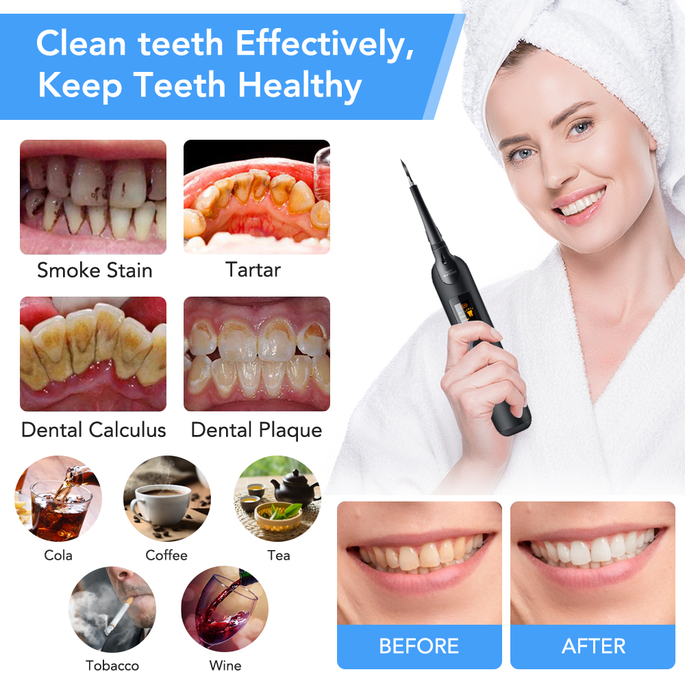 Teeth Tartar Remover Electric  - Teeth Whitening Home Kit 리뷰 및 가격