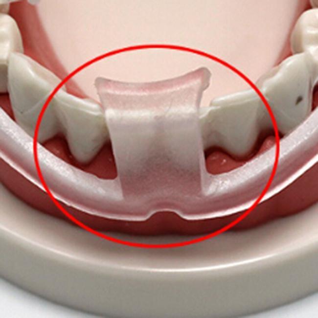 Dental Mouth Guard for Teeth G - Teeth Whitening Mouth Guard 리뷰 및 가격