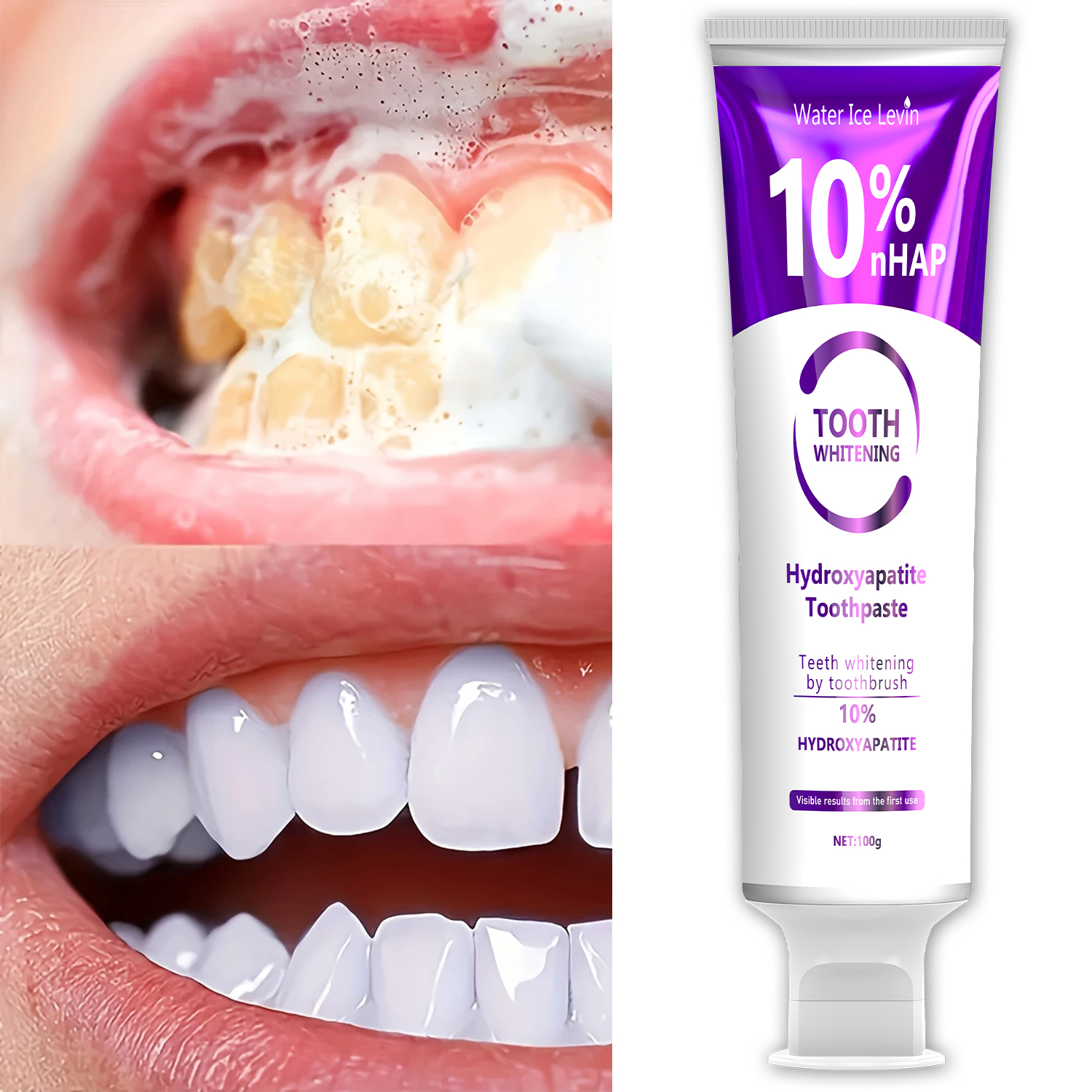 10% Nanoh Hydrogen Oxide Tooth - Hydroxyapatite Toothpaste 리뷰 및 가격