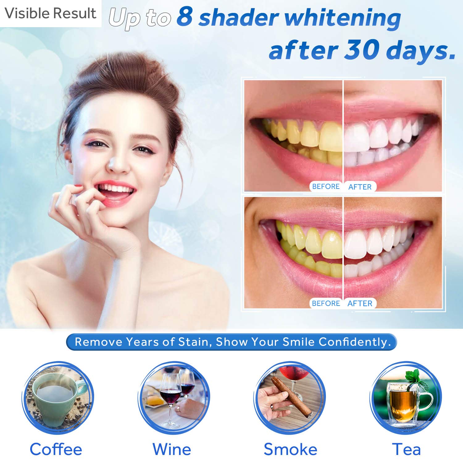 Teeth Whitening Gel Refill Syr - Teeth Whitening Remedies 리뷰 및 가격