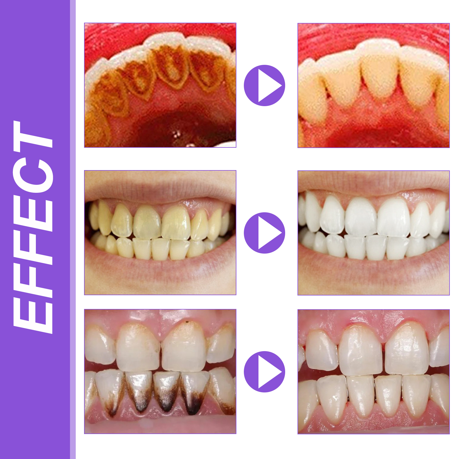 EELHOE Smiles Bright White Ref - Hydroxyapatite Toothpaste 리뷰 및 가격