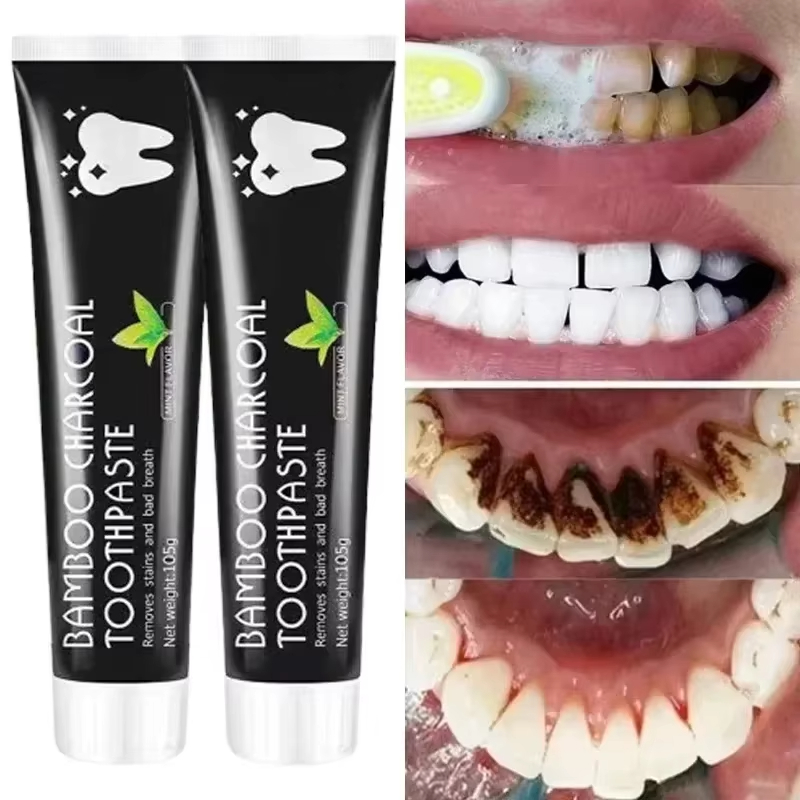 Whitening Toothpaste Bamboo Ch - Teeth Whitening Remedies 리뷰 및 가격