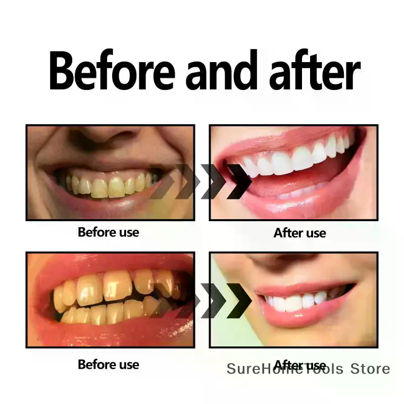 Bamboo Charcoal Powder For Tee - Teeth Whitening Quotes 리뷰 및 가격