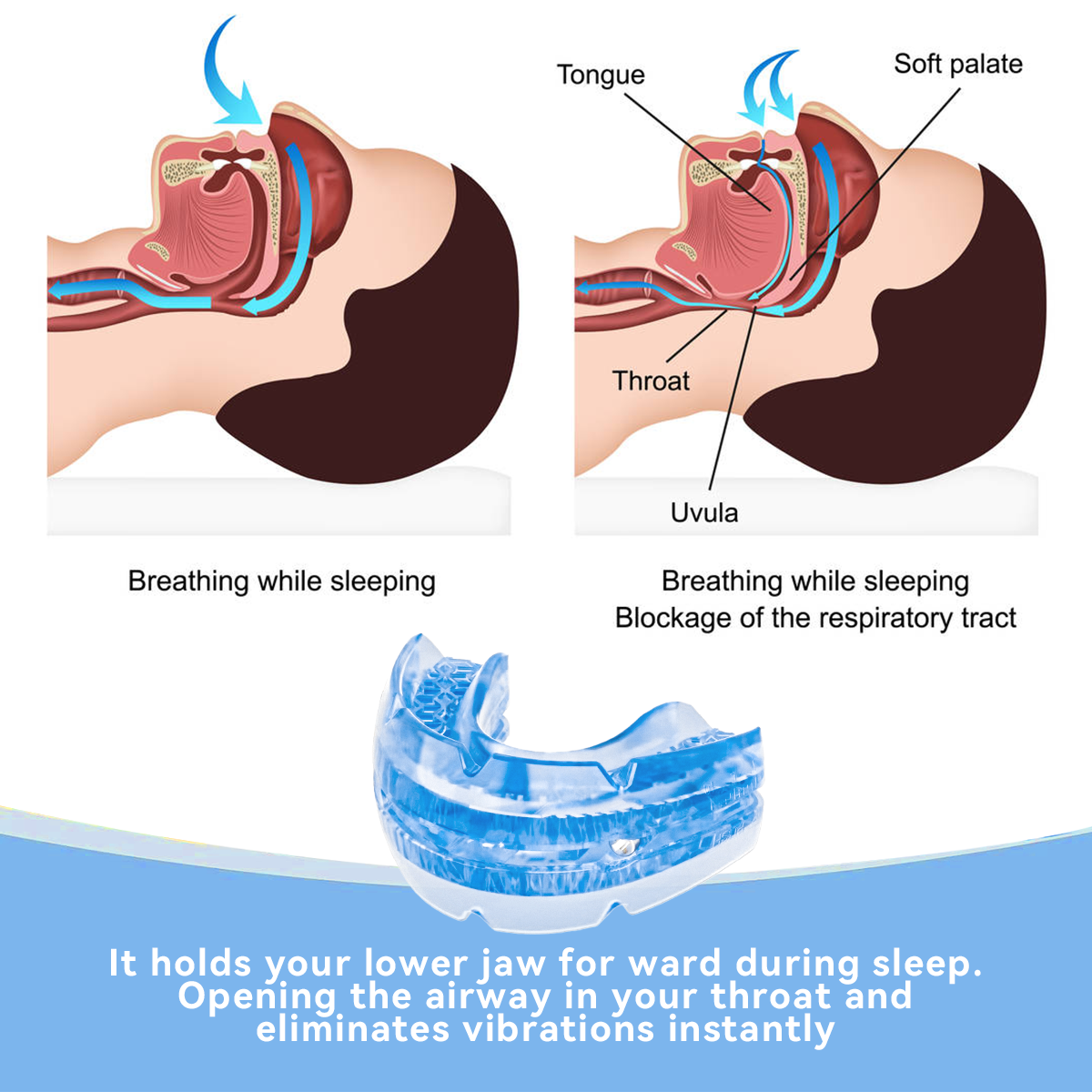 Anti Snore Bruxism Mouth Guard - Teeth Whitening Mouth Guard 리뷰 및 가격