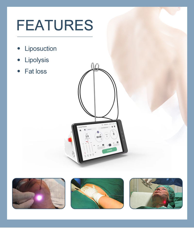 Dental Laser Teeth Whitening D - Teeth Whitening Laser 리뷰 및 가격