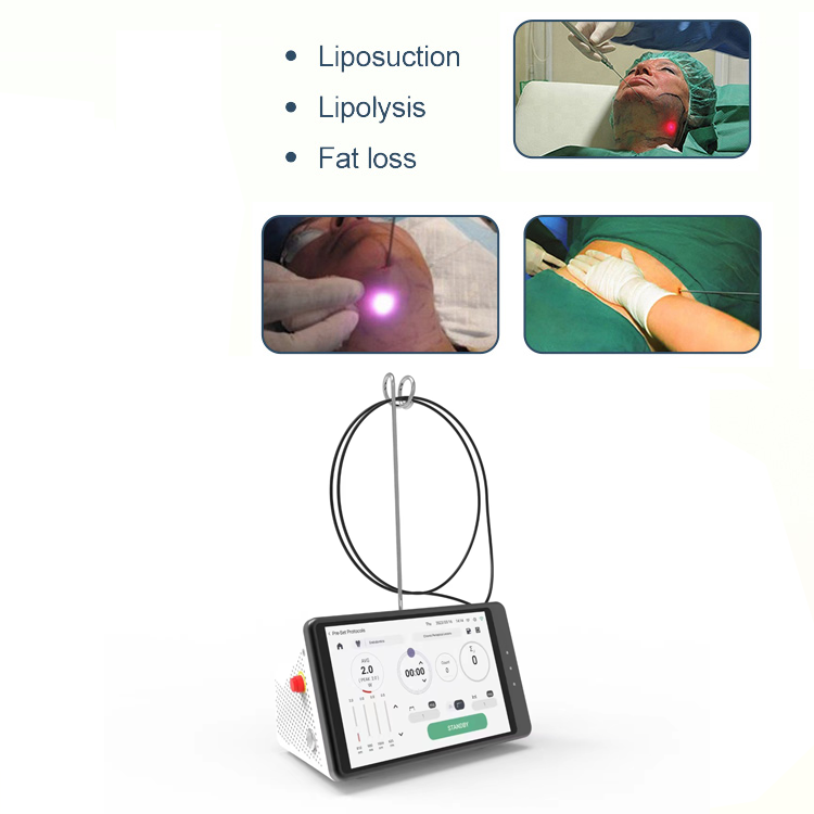 Dental Laser Teeth Whitening D - Teeth Whitening Laser 리뷰 및 가격