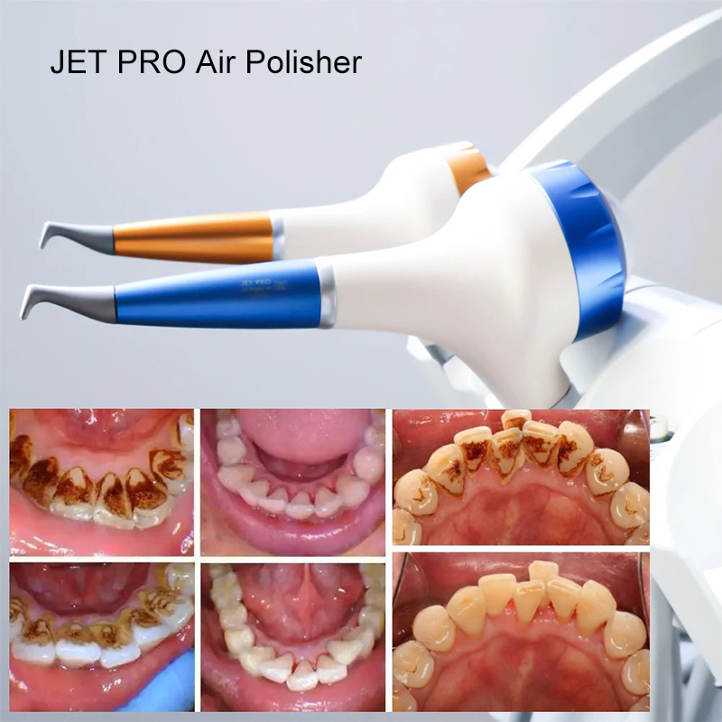 VV Dental  Air Polishing Proph - Teeth Whitening Dental 리뷰 및 가격