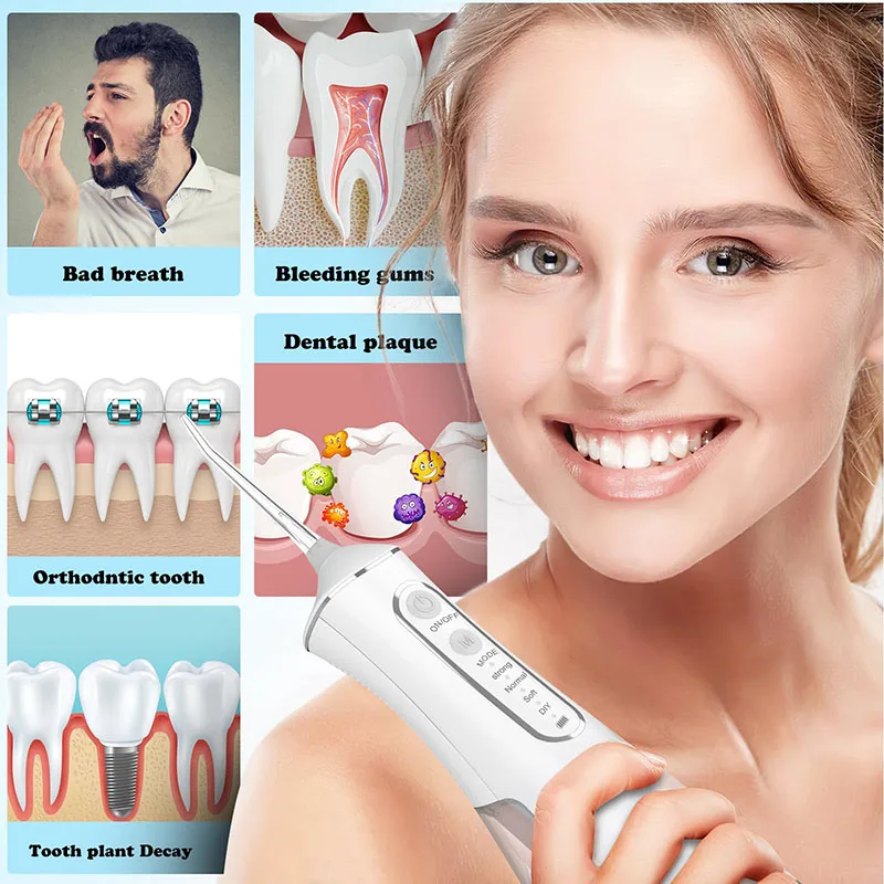 Portable Dental Water Irrigato - Teeth Whitening Laser 리뷰 및 가격