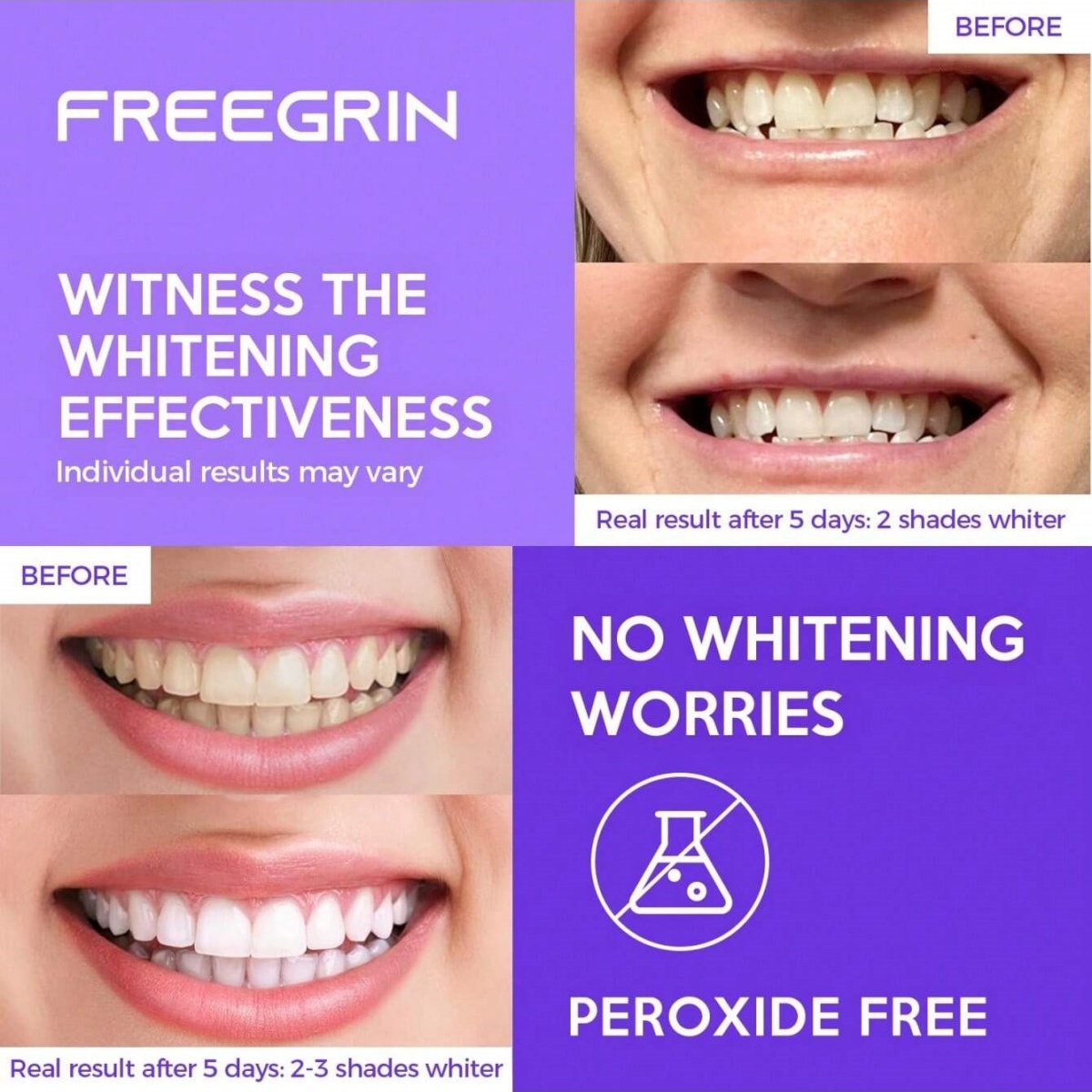 Deluxe Whitening Teeth Sticker - Teeth Whitening In Office 리뷰 및 가격