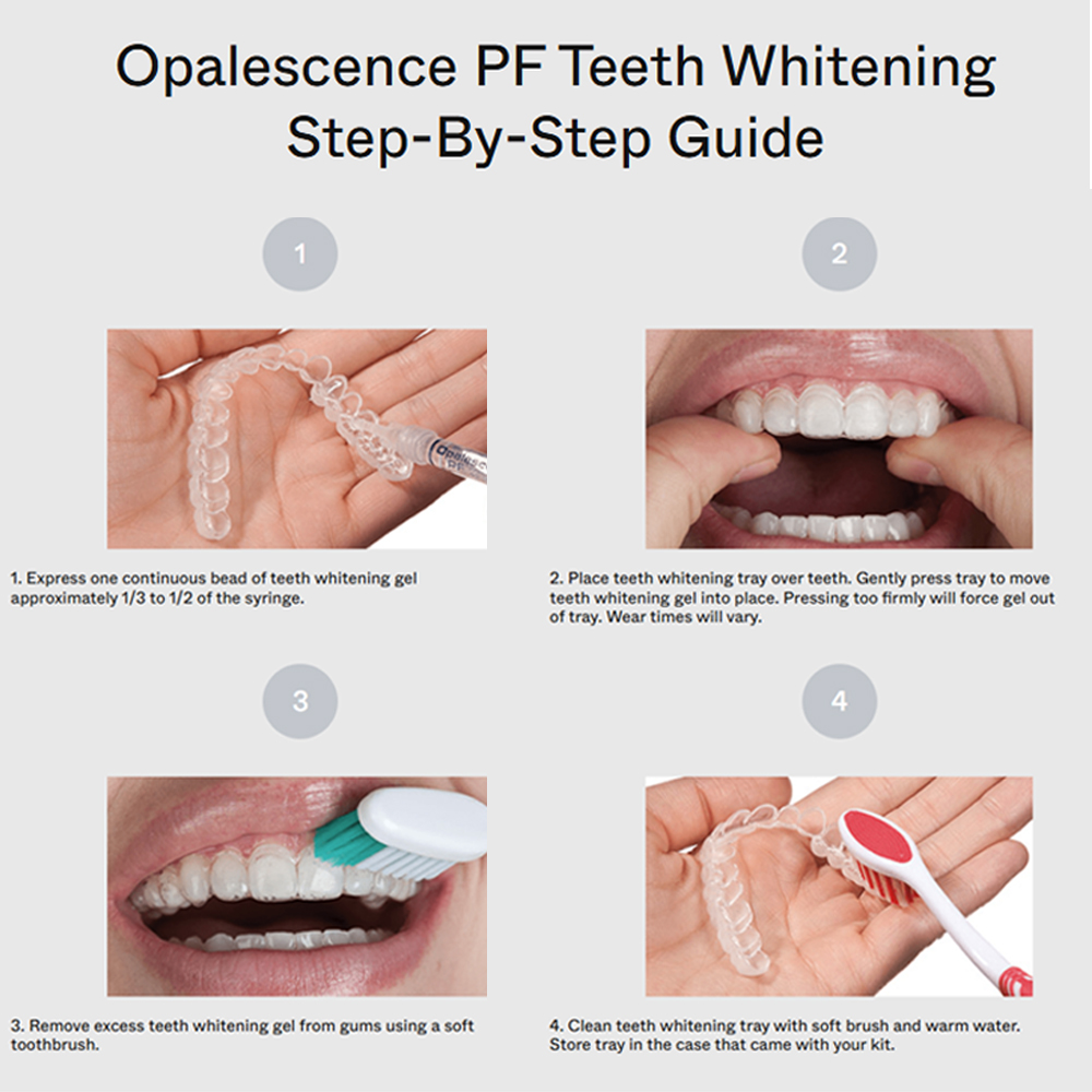 opalescence pf 15% refill kit  - Teeth Whitening Gel Opalescence 리뷰 및 가격