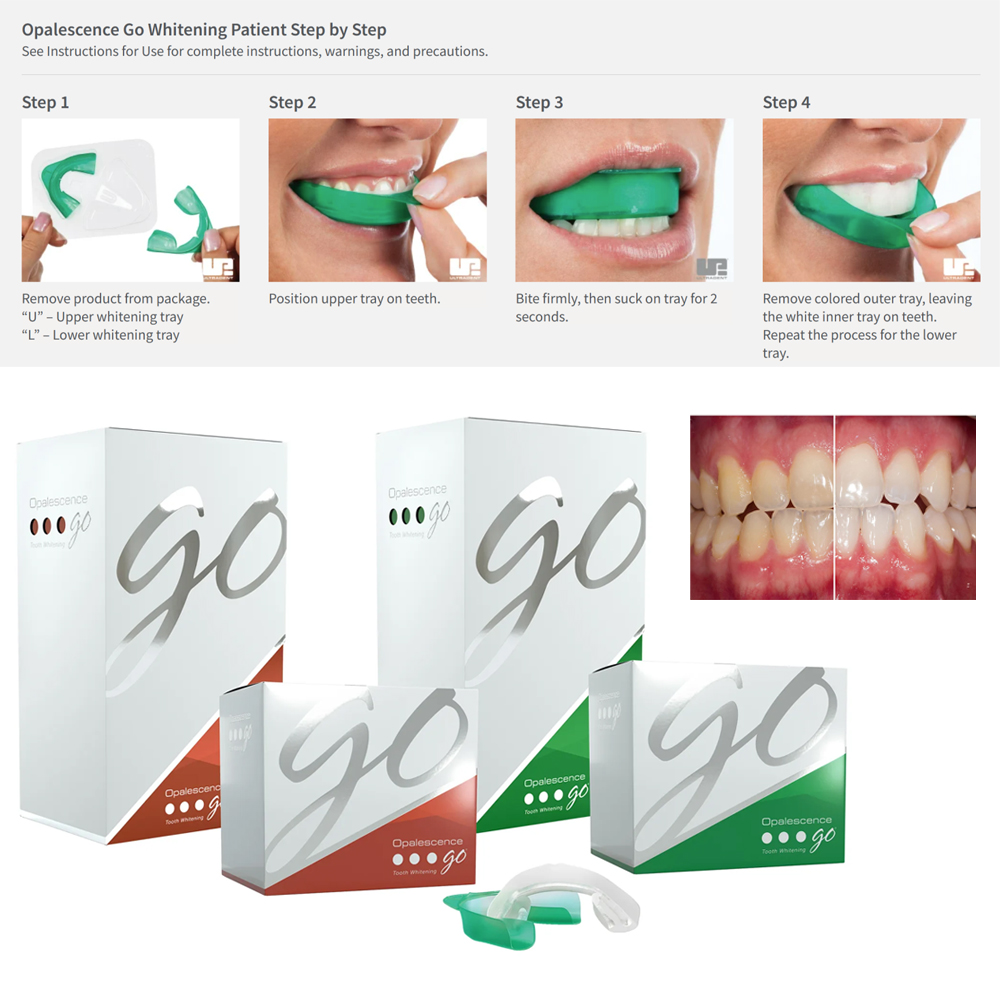 Opalescence Go Teeth Whitening - Teeth Whitening Home Kit 리뷰 및 가격