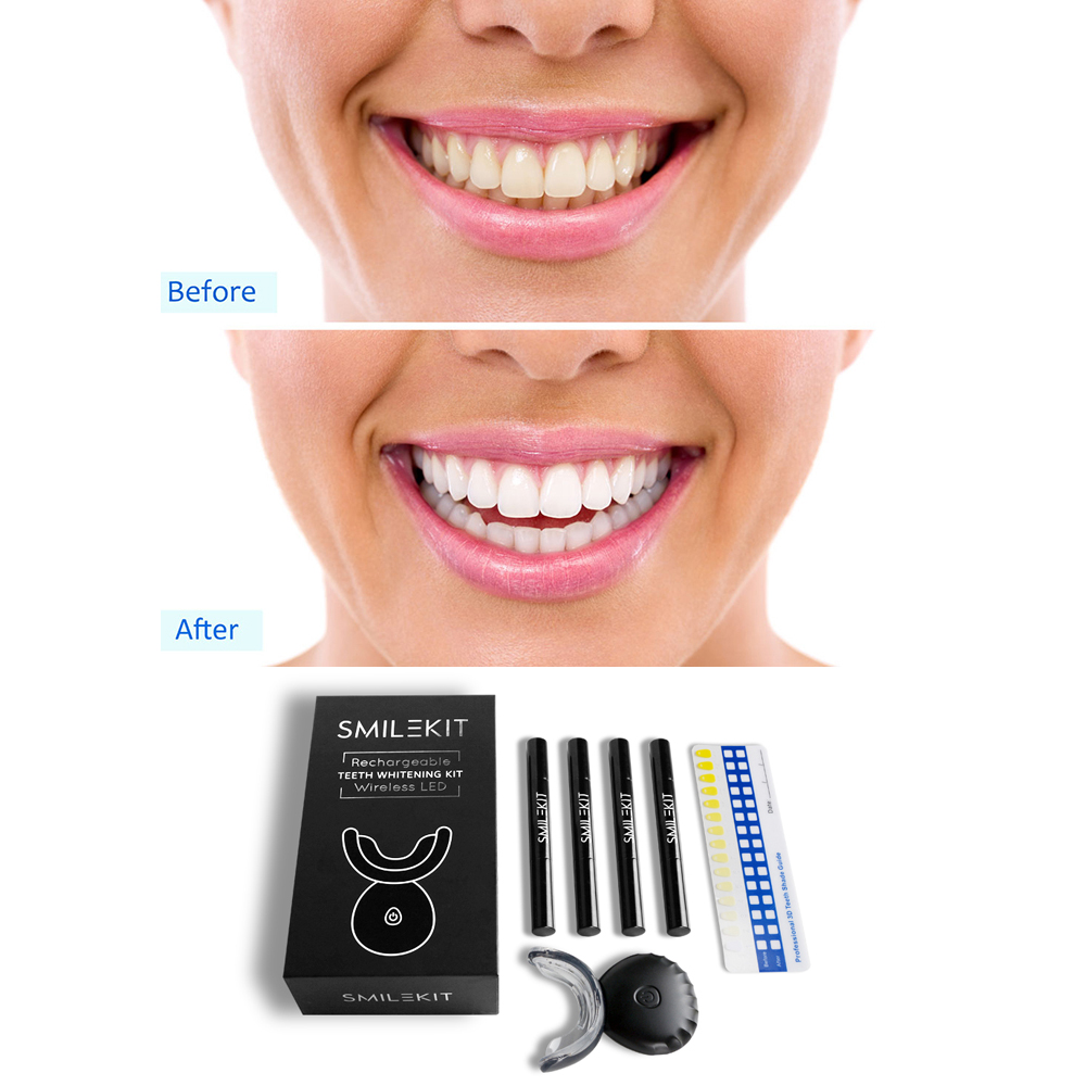 New Electric Teeth Whitening L - Teeth Whitening Home Kit 리뷰 및 가격