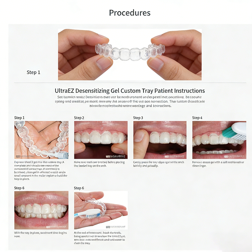 Ultra Ez Dental Desensitizing  - Teeth Whitening Gel Opalescence 리뷰 및 가격