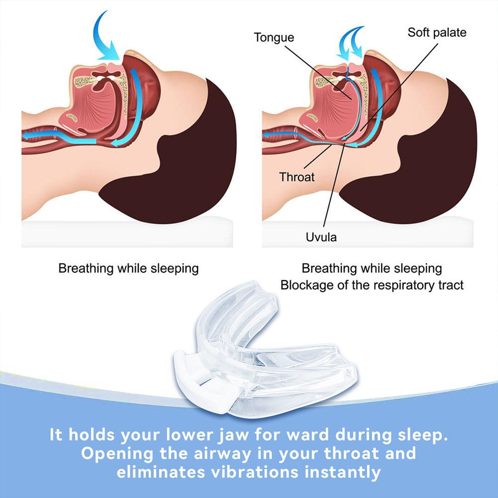 Anti Snoring Bruxism Mouth Gua - Teeth Whitening Mouth Guard 리뷰 및 가격
