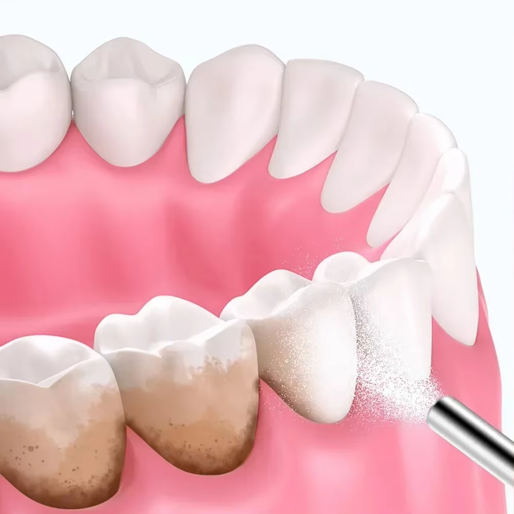 Dental Sandblasting Powder 500 - Teeth Whitening Quotes 리뷰 및 가격
