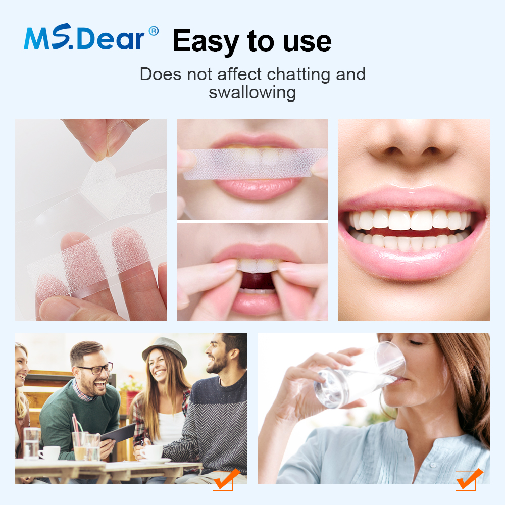 Teeth Whitening Strips Cleansi - Teeth Whitening Remedies 리뷰 및 가격